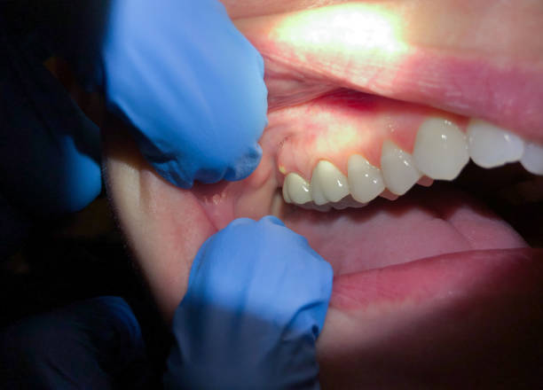 Best Emergency Denture Repair in Tool, TX